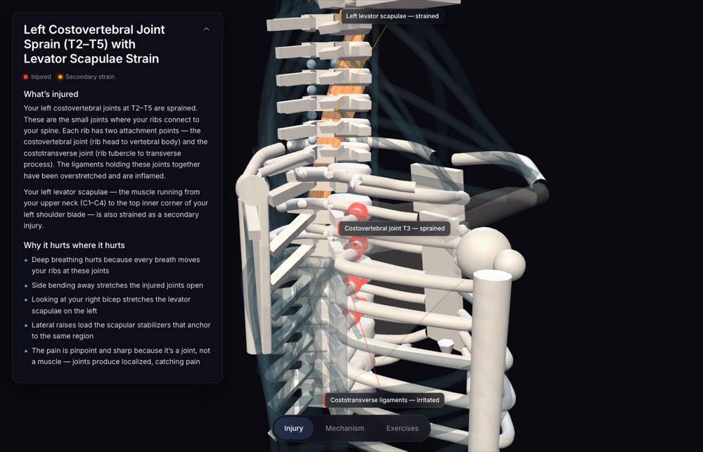 BJJ injury visualizer — posterior view of a 3D thoracic spine with the left T2–T5 costovertebral joints glowing red